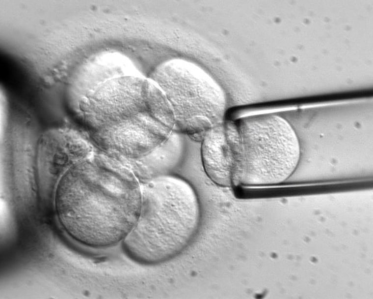 Image: Photomicrograph shows a single cell being removed from an eight-cell-stage human embryo