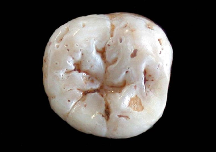 Image: Neanderthal tooth