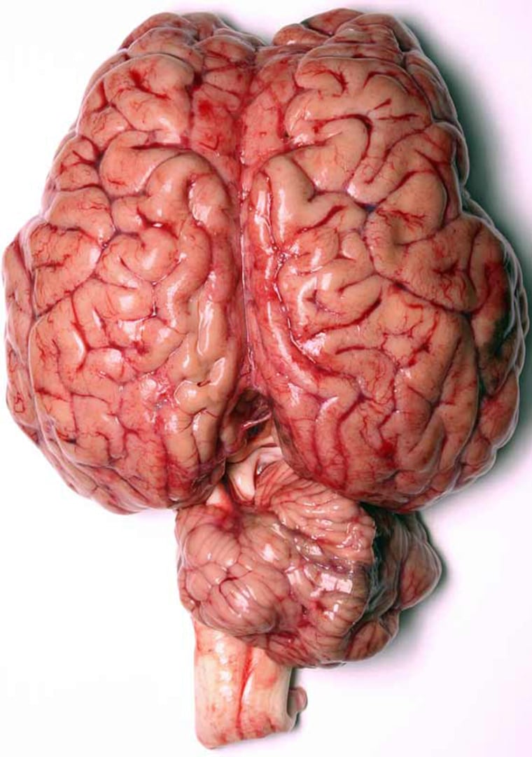 Image: Human brain