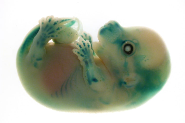 Image: Two-week-old mouse foetus