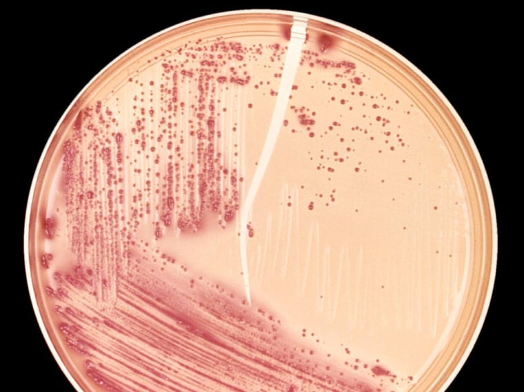 Image: E. coli in a petri dish