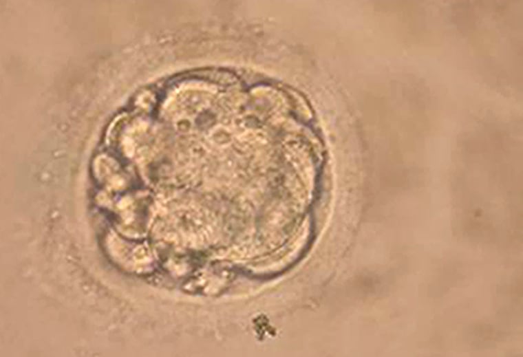 South Korean Researchers Clone Human Embryo