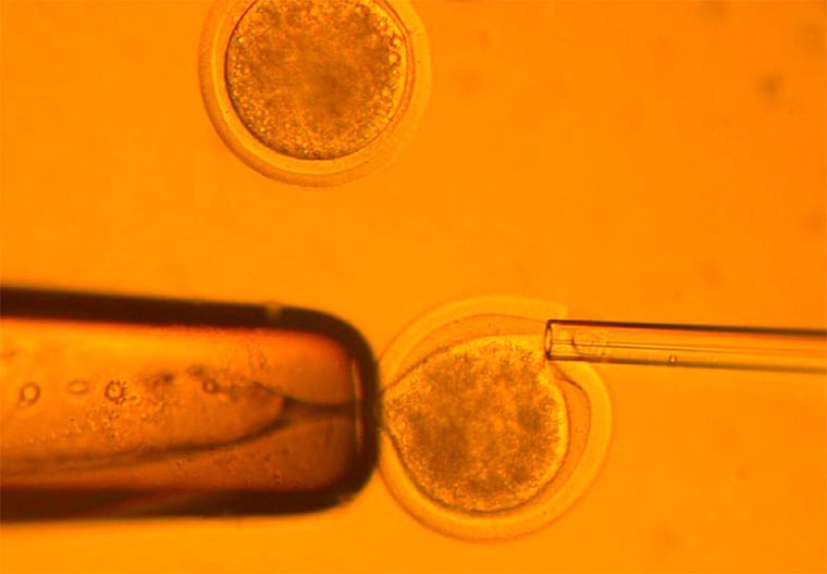 MICROSCOPIC PHOTO OF INJECTION OF SOMATIC CELL INTO NUCLEAR REMOVED-HUMAN EGG CELL