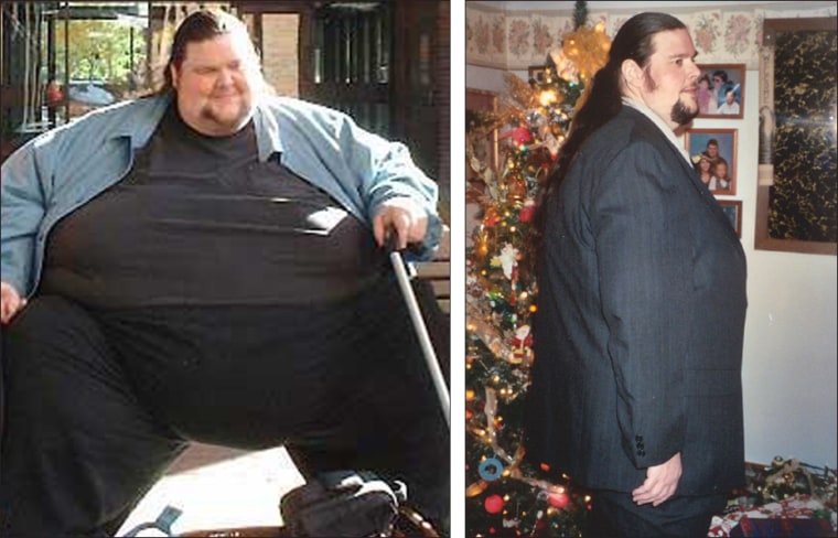 Kirk Thompson had skin removed from his stomach and thighs after losing 400 pounds with the help of gastric bypass surgery. In April, he'll have more plastic surgery. 