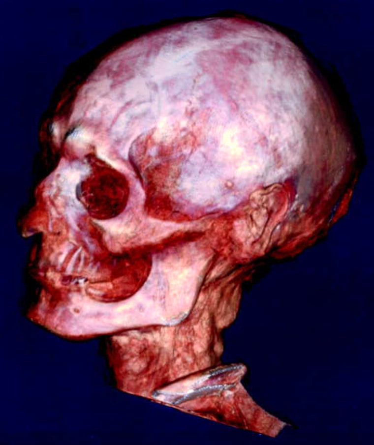 A technique called multidetector computed tomography produced this three-dimensional view of a nearly 3,000-year-old skull without disturbing the mummy's wrappings.