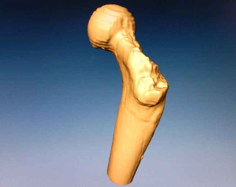 This computerized graphic shows the reconstruction of the fossil thighbone through a three-dimensional CT scan.