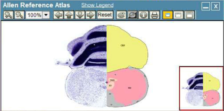 A screenshot from the Allen Brain Atlas shows how brain anatomy images can be correlated with gene location, using a computerized viewing filter.