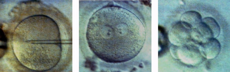 During a fertility technique known as intracytoplasmic sperm injection, doctors inject a sperm into an egg. If the fertilization is successful, the egg begins to divide and quickly becomes a tiny ball of cells.