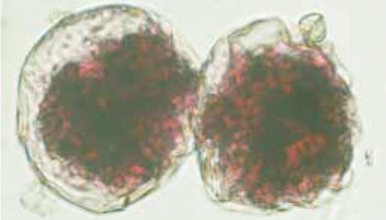 Hundreds of single-celled organisms known as foraminifera were found in a sample of sediment collected from the Challenger Deep, including these spherical creatures known as organic-walled allogromiids. Reprinted with permission from Science (307:689 (2005)).