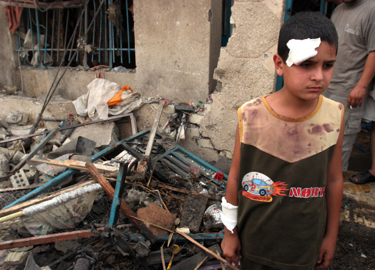 An injured Iraqi boy stands at the site where a suicide car bomber slammed into American troops as they distributed candy to children, killing 26 youngsters and a U.S. soldier, in the Baghdad neighborhood of al-Khalij, on July 13. 