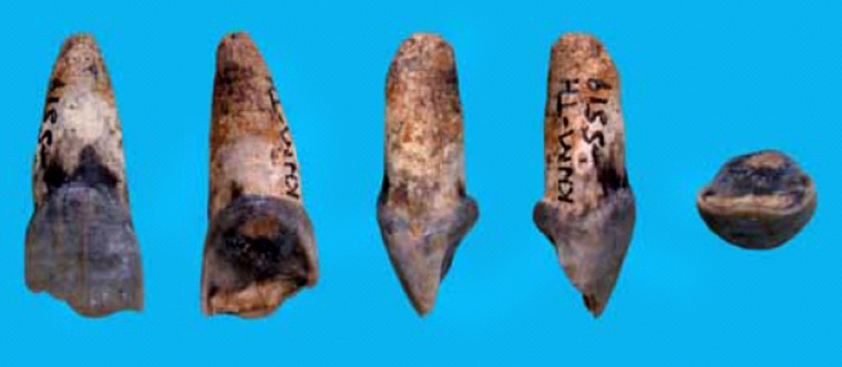 This image shows several views of one of the first fossilized chimpanzee teeth ever discovered. Radioactive dating indicates that the teeth are up to 545,000 years old.