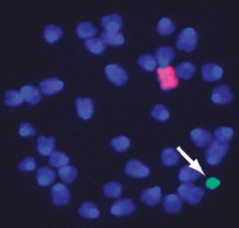 A copy of human chromosome 21 (indicated in green) was added to mouse embryonic stem cells, yielding mice with symptoms of Down syndrome.