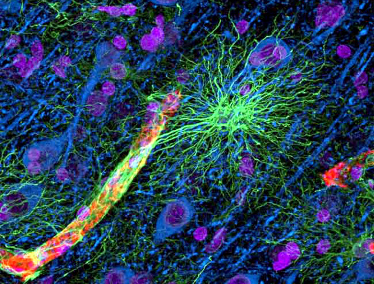 A false-color view of human brain tissue shows an astrocyte (green) reaching out to a blood vessel (yellow and red). The neurons (blue) are not in direct contact with the vessel and rely on astrocytes for the transport of nutrients of waste. 