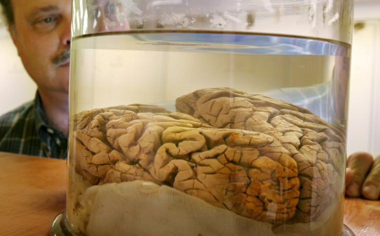 SLUG: ST-BODYPART2 175382 PHOTOGRAPHER: NIKKI KAHN/THE WASHINGTON POST DATE: 12/08/2005 LOCATION: National Museum of Natural History Washington, DC CAPTION: Physical Anthropologist David R. Hunt, Ph.D. talks about the brain of Major J.W. Powell at the Smithsonian Institution of Natural History in Washington, D.C., on Thursday, December 8, 2005. Powell won a bet with friend Dr. W.J. McGee that his brain was bigger. It was 5 percent larger than McGee as measured by Edward Anthony Spitzka. StaffPhoto imported to Merlin on Thu Dec 8 18:48:06 2005