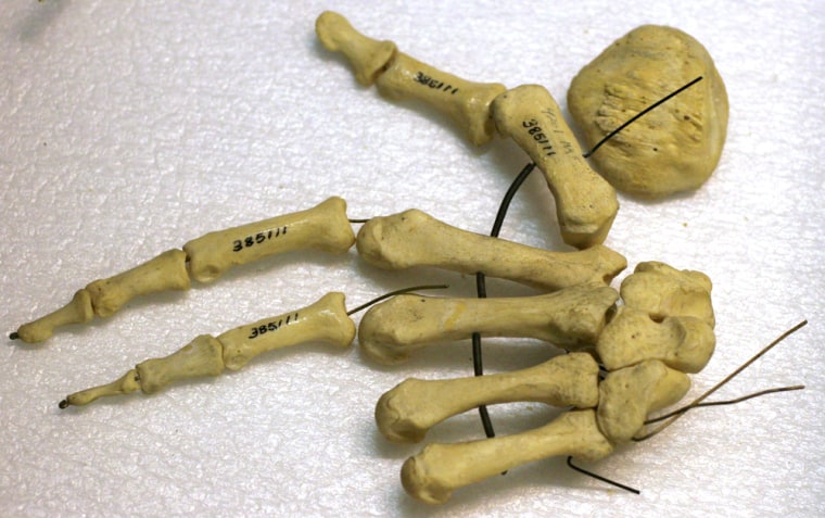 SLUG: ST-BODYPART1 175278 PHOTOGRAPHER: NIKKI KAHN/THE WASHINGTON POST DATE: 12/06/2005 LOCATION: NATIONAL MUSEUM OF HEALTH AND MEDICINE 6900 Georgia Avenue., NW CAPTION: Parts of Charles Guiteau's hand are among the specimens at National Museum of Health and Medicine in Washington, D.C., on Tuesday, December 6, 2005. Guiteau shot President James A. Garfield in 1881. StaffPhoto imported to Merlin on Wed Dec 7 17:32:11 2005