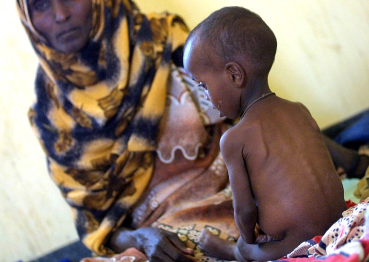 Malnourished boy sits at a MSF hospital in El Wak Kenya