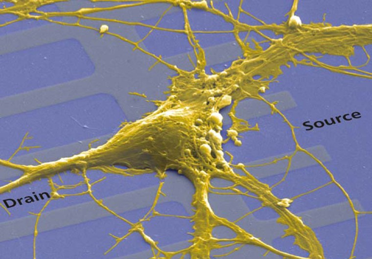 A neuron from a rat brain sprawls over a linear array of transistors. The cell's ionic current interacts with the electronic current in the silicon.