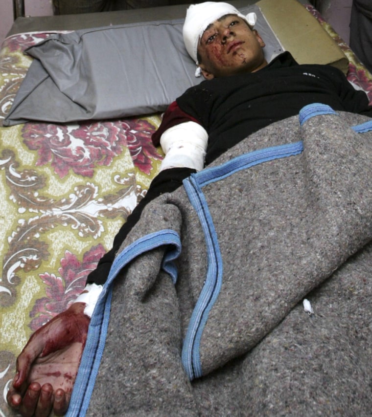 A resident who was wounded in a mortar attack lies in the Imam Ali hospital in Baghdad's Sadr city