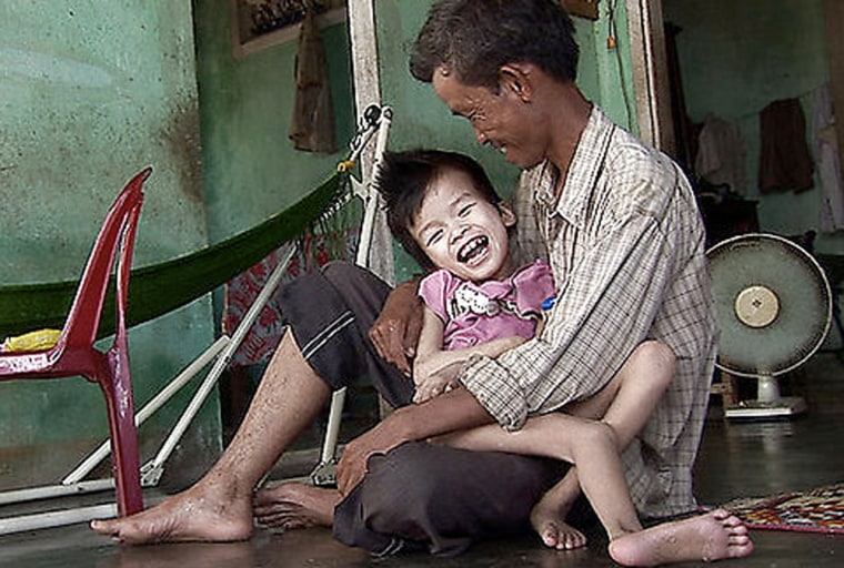 Pham Van Xong and his 9-year-old son Truc, who local medical officials say is a victim of Agent Orange, in An Trach, Vietnam. 