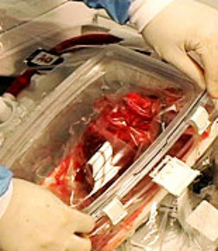 The Organ Care System keeps the heart beating outside of the body.