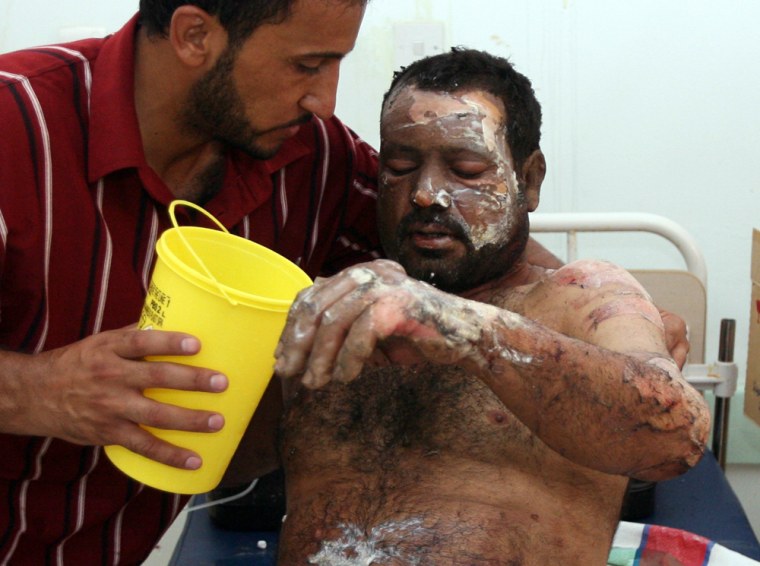 A relative gives water to a bomb attack victim in Imam Ali hospital in Baghdad's Sadr City