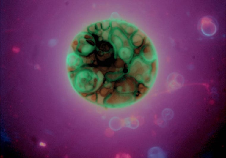 This photo, provided by ProtoLife, shows vesicles, artificial membranes for cells, made from scratch. Such synthetic structures could conceivably reproduce themselves, but would that constitute the creation of life?