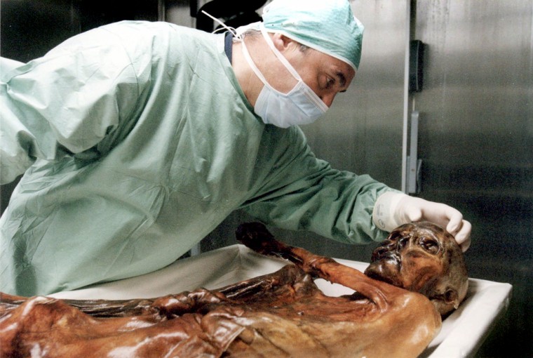 A researcher examines the 5,200-year-old body of a Bronze Age hunter known as Ötzi in Bolzano, Italy.