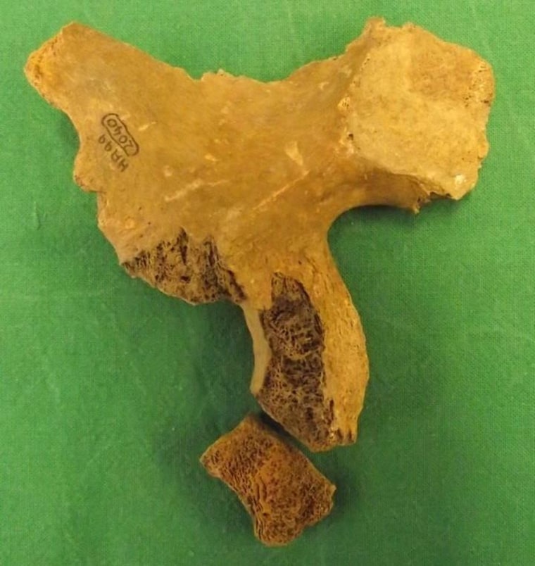 Image: Pelvis