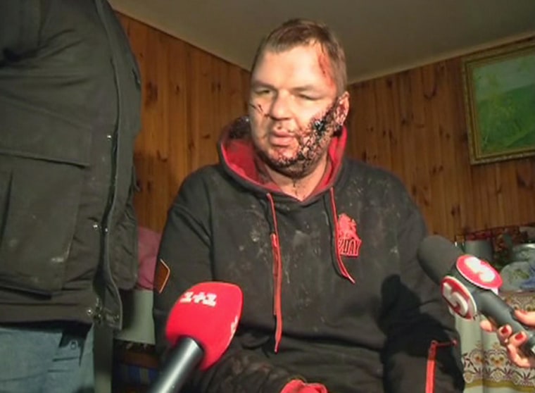 Image: Bulatov, 35, one of the leaders of anti-government protest motorcades called 'Automaidan', speaks to journalists after being found near Kiev