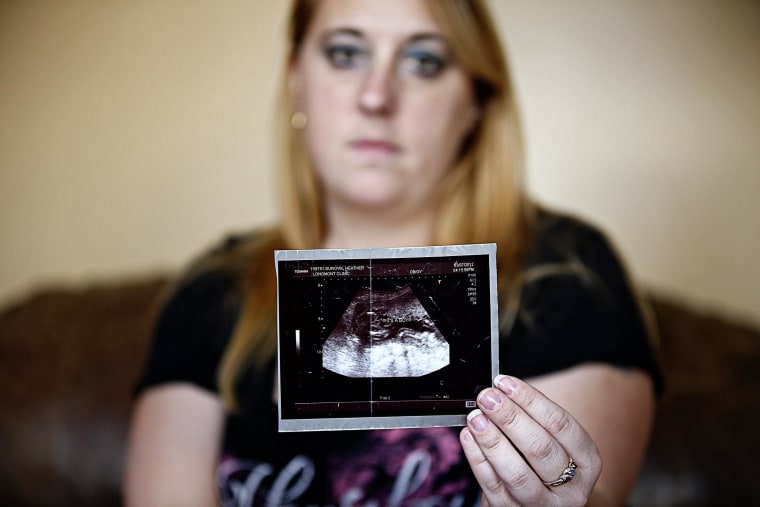 Image: Heather Surovik holds a sonogram of her son Brady Paul