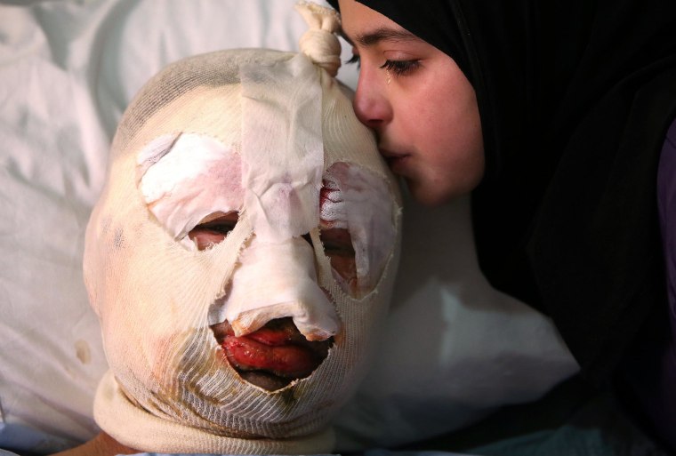 Image: Teen kisses injured father after car bomb in Hermel, Lebanon, on Feb. 2