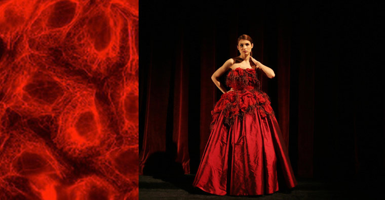 Image: A ball gown inspired by microscopic photos of cancer cells designed by a University of British Columbia costume design professor