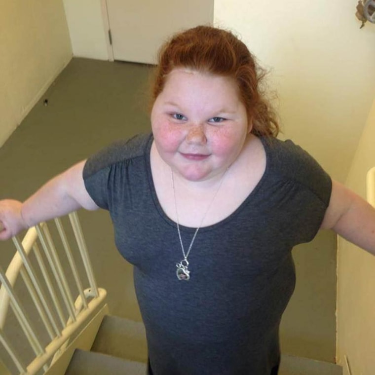 Alexis Shapiro, 12, of Cibolo, Texas, is improving steadily after weight-loss surgery on March 21. The surgery, which was originally rejected by her father’s insurance company, has reversed her diabetes and helped her lose at least 12 pounds, doctors said.
