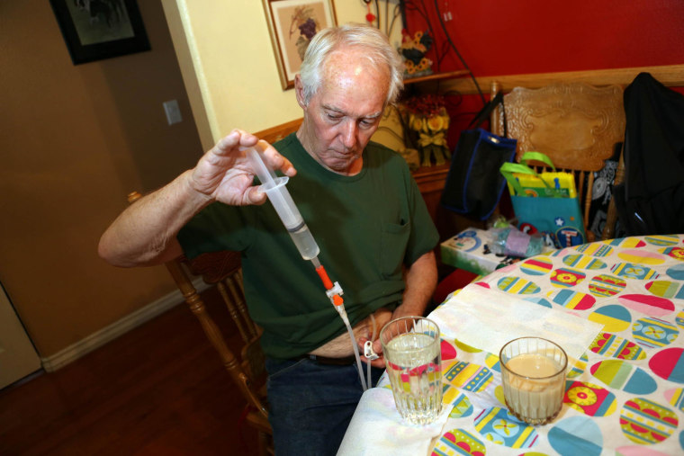 Image: Bob Hoaglan uses a feeding tube to eat due to ALS