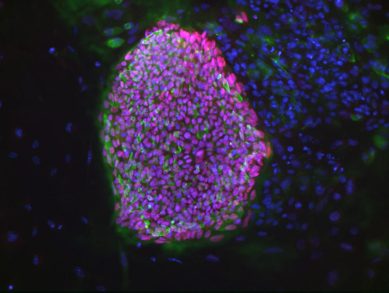 A colony of an embryonic stem cell 