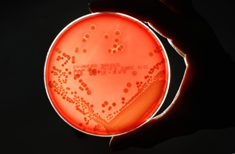 Image: MRSA bacteria strain is seen in a petri dish in a microbiological laboratory in Berlin