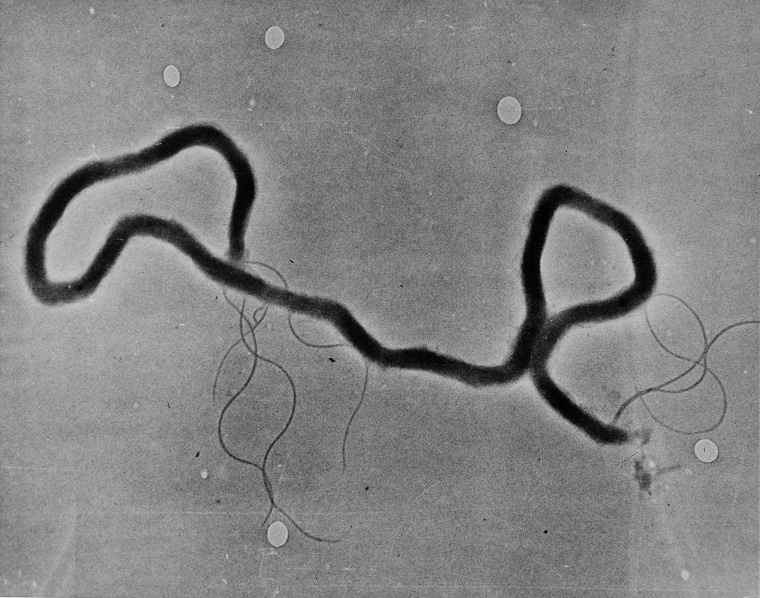 The organism treponema palladium, which causes syphilis, is seen through an electron microscope on May 23, 1944.