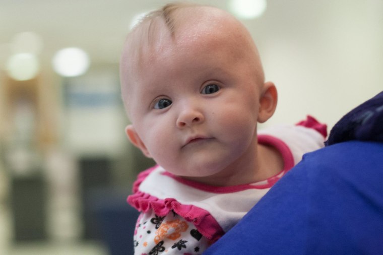Image: Baby receives treatment for spina bifida
