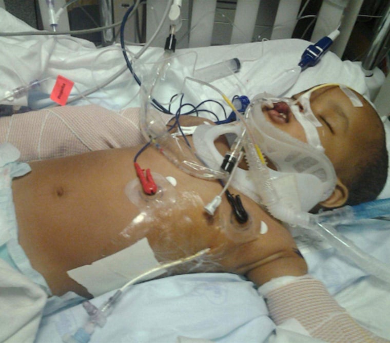 Image: Musa Dayib, 15-months-old, survived an 11-story fall from a building in Minneapolis and survived.