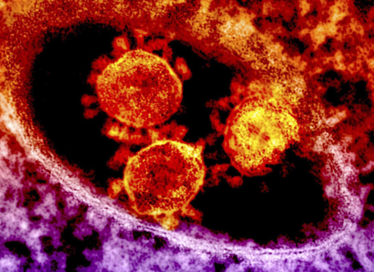 Image: MERS