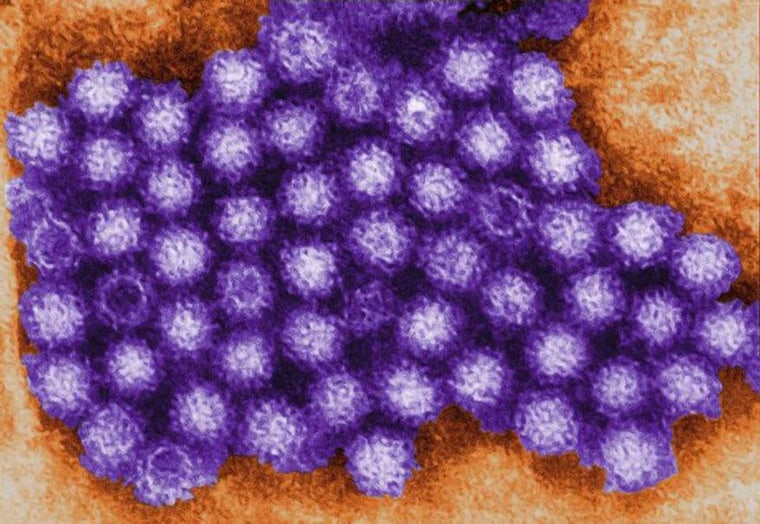 Image: A close-up of a norovirus that is causing food poisoning.
