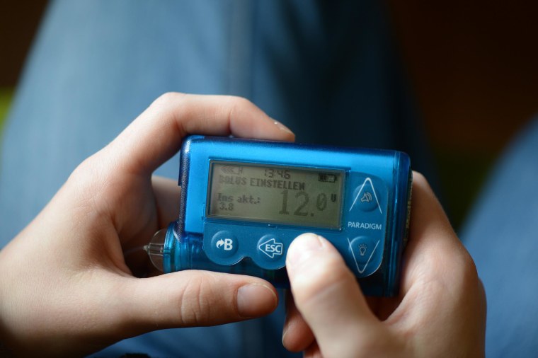 A young girl, suffering from diabetes type 1, sets the bolus of her insulin pump which monitors the consumption of carbohydrates in her body in Berlin, Germany on Feb. 19. 