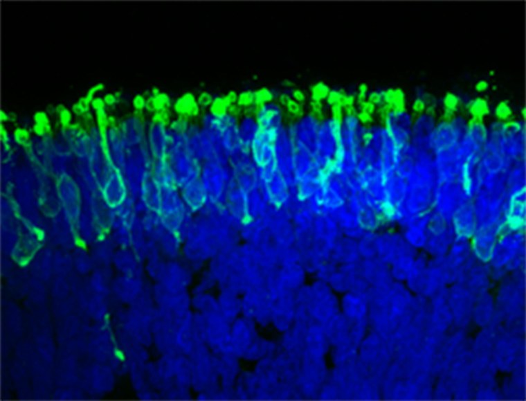 Image: Rod photoreceptors (in green) within a "mini retina" derived from human iPS cells in the lab