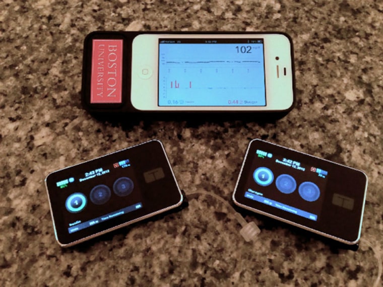 The bionic pancreas developed by a Boston University/Massachusetts General Hospital research team consists of a smartphone hardwired to a continuous glucose monitor and two pumps that deliver doses of insulin or glucagon every five minutes. 