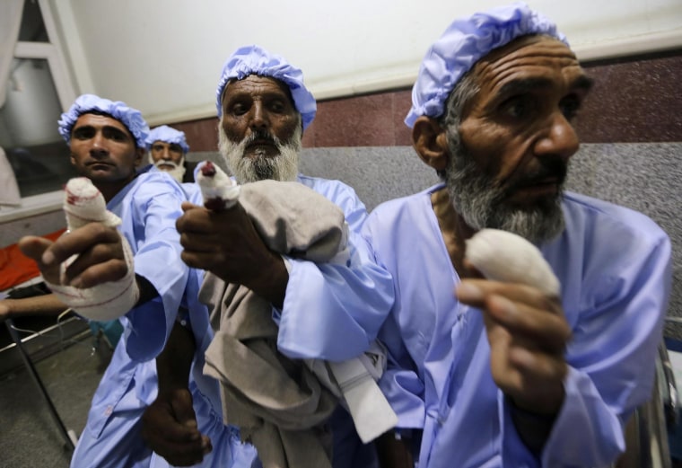 Image: Men show their fingers after the ink-stained part of their fingers were cut off by the Taliban after they took part in the presidential election