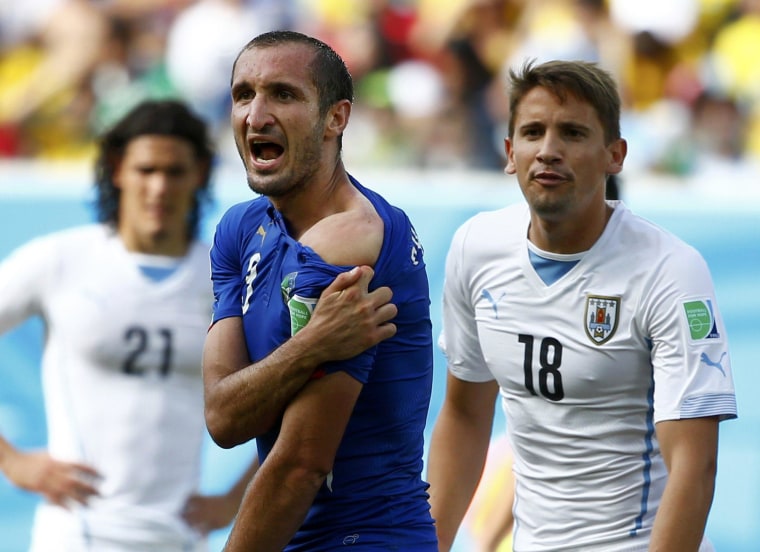 Image: Italy's Giorgio Chiellini shows his shoulder, claiming he was bitten by Uruguay's Luis Suarez