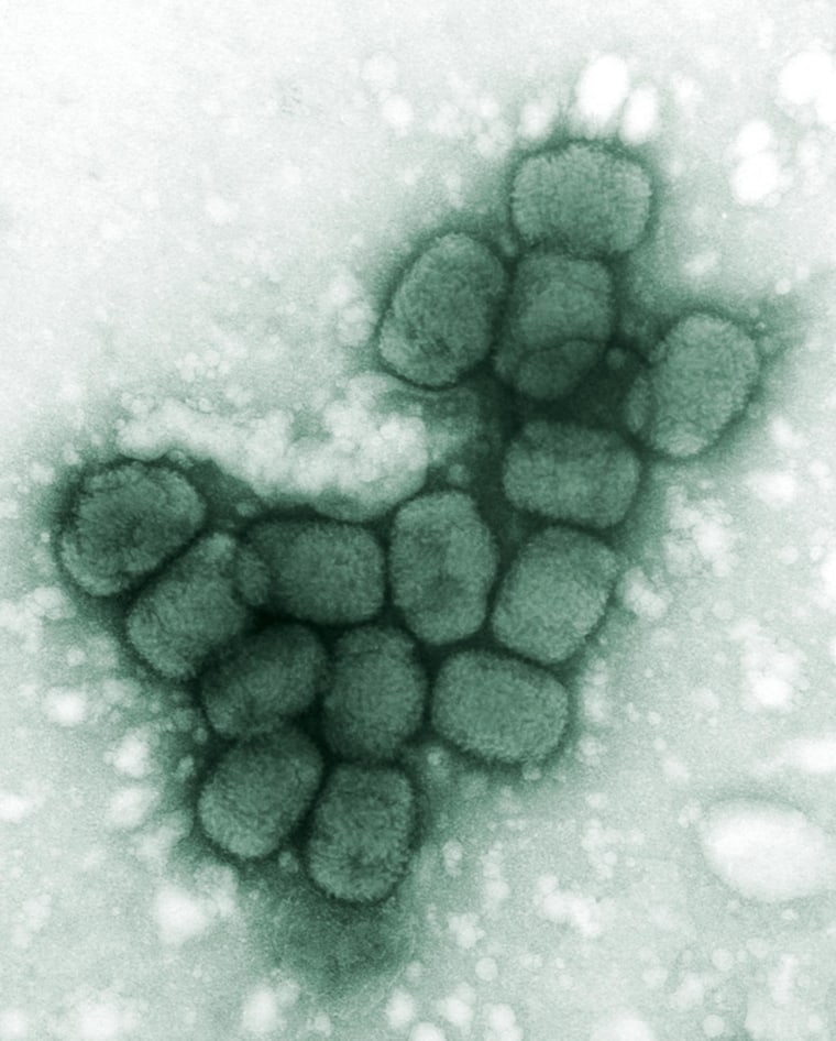 Image: A transmission electron micrograph of smallpox viruses using a negative stain technique