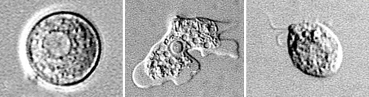 Image: Naegleria fowleri, a deadly amoeba