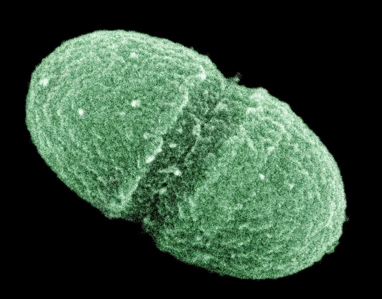 Image: Enterococcus faecalis