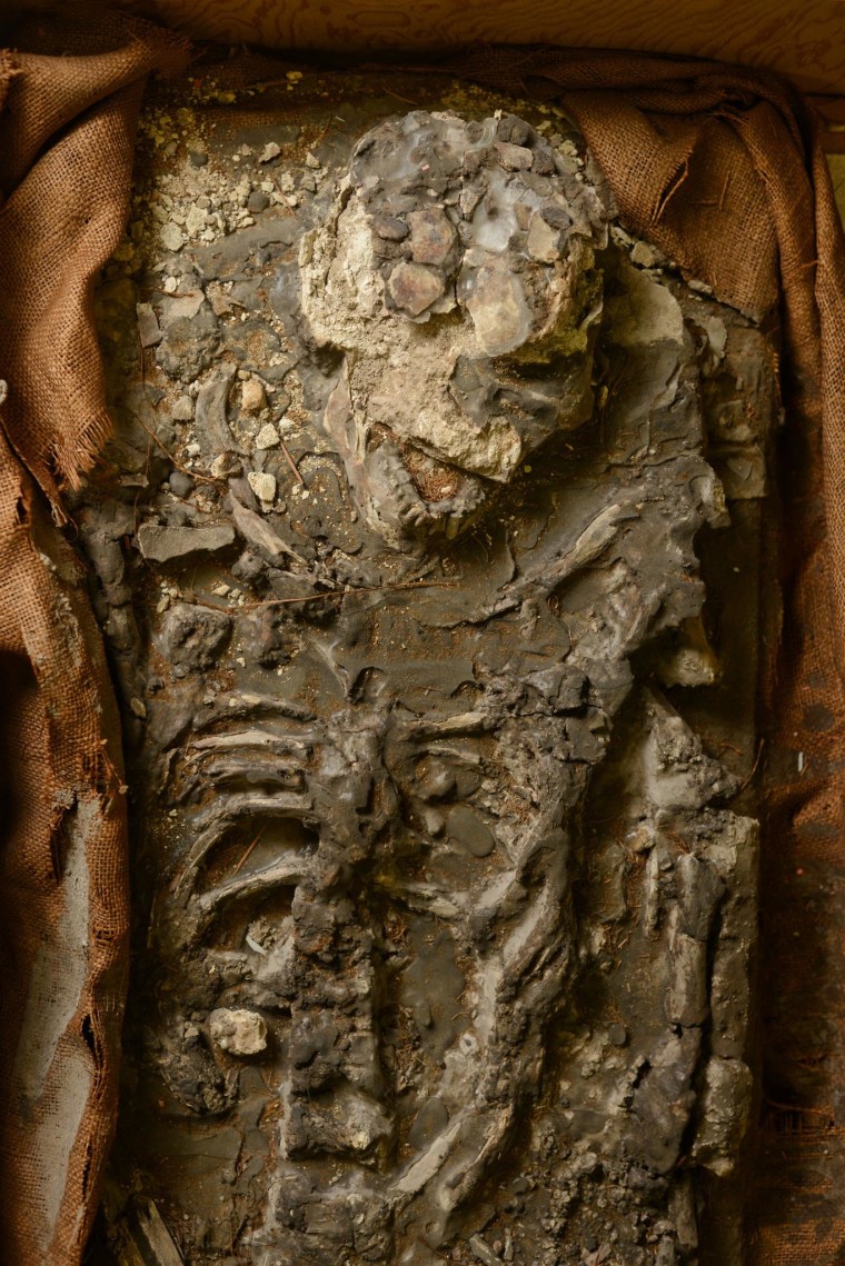 Image: Upper body and skull